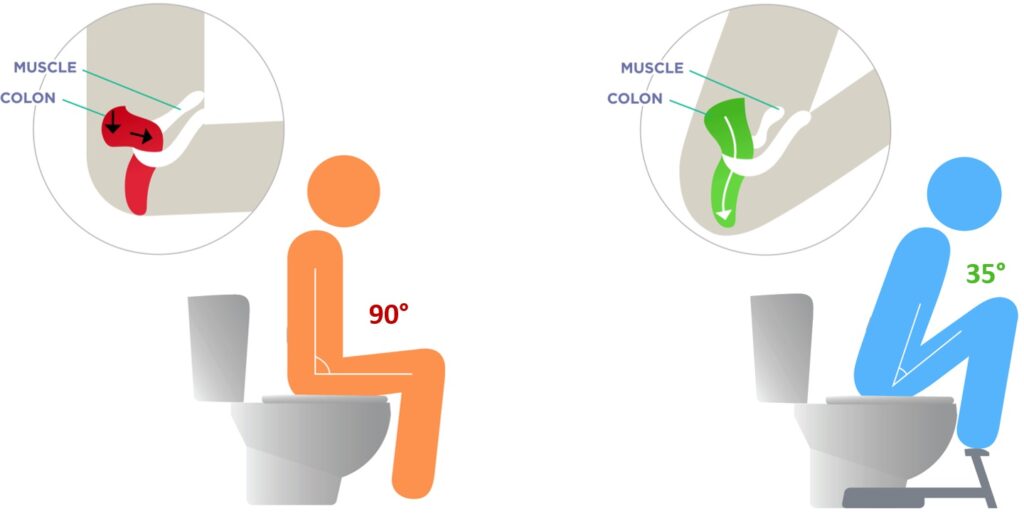 Position physiologique sur les toilettes